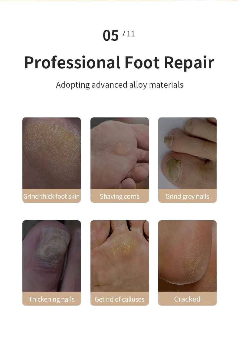 Best for Dead Skin Remover