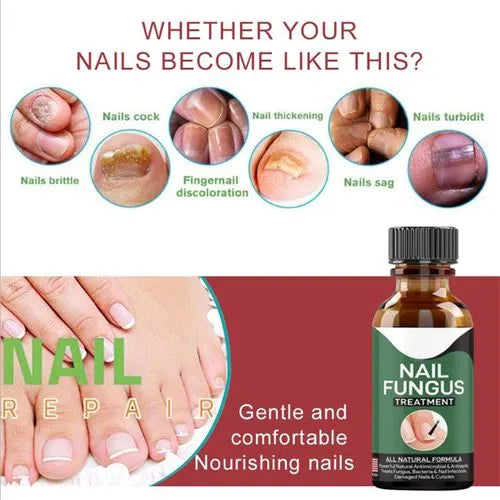 Nail Fungus Treatment Serum